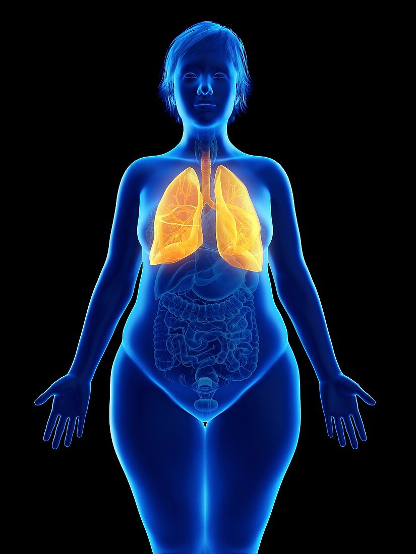 Illustration of an obese woman's lung