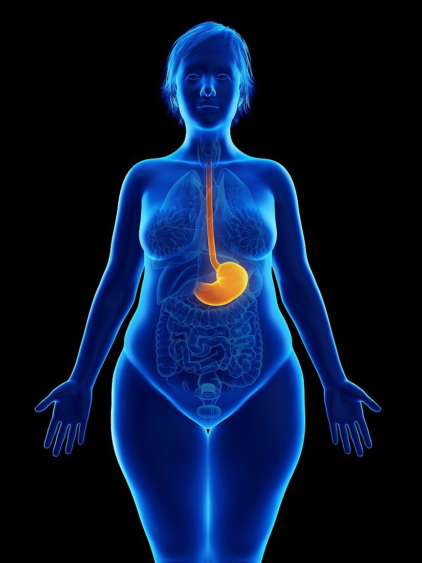 Illustration of an obese woman's stomach