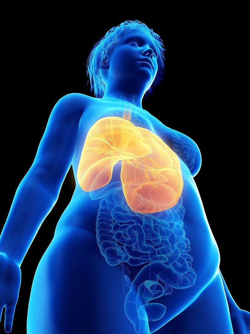 Illustration of an obese woman's lung
