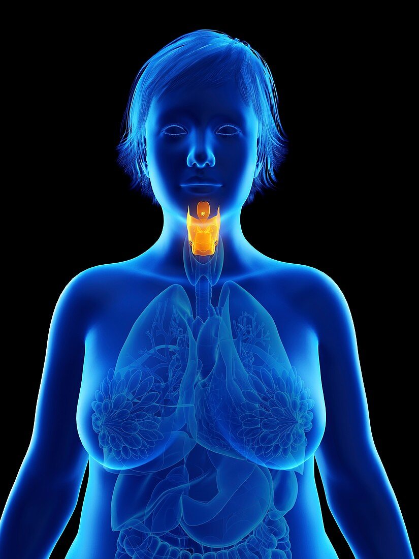 Illustration of an obese woman's larynx