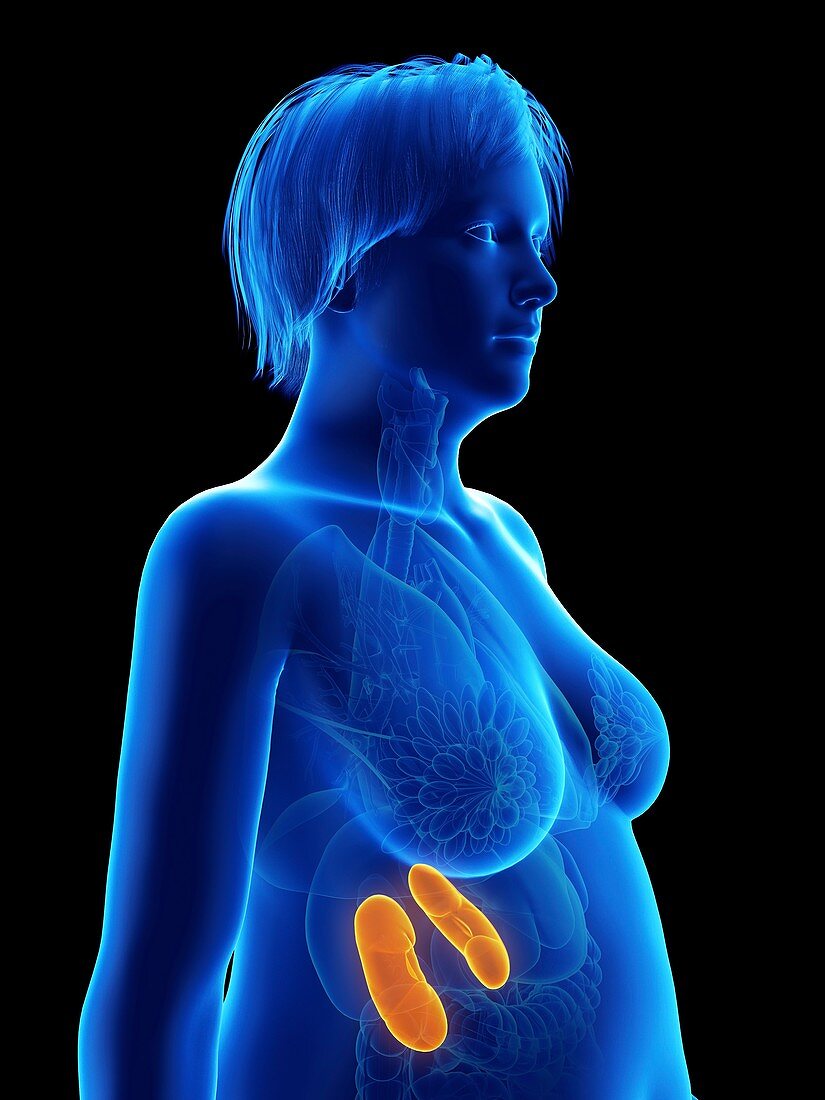 Illustration of an obese woman's kidneys