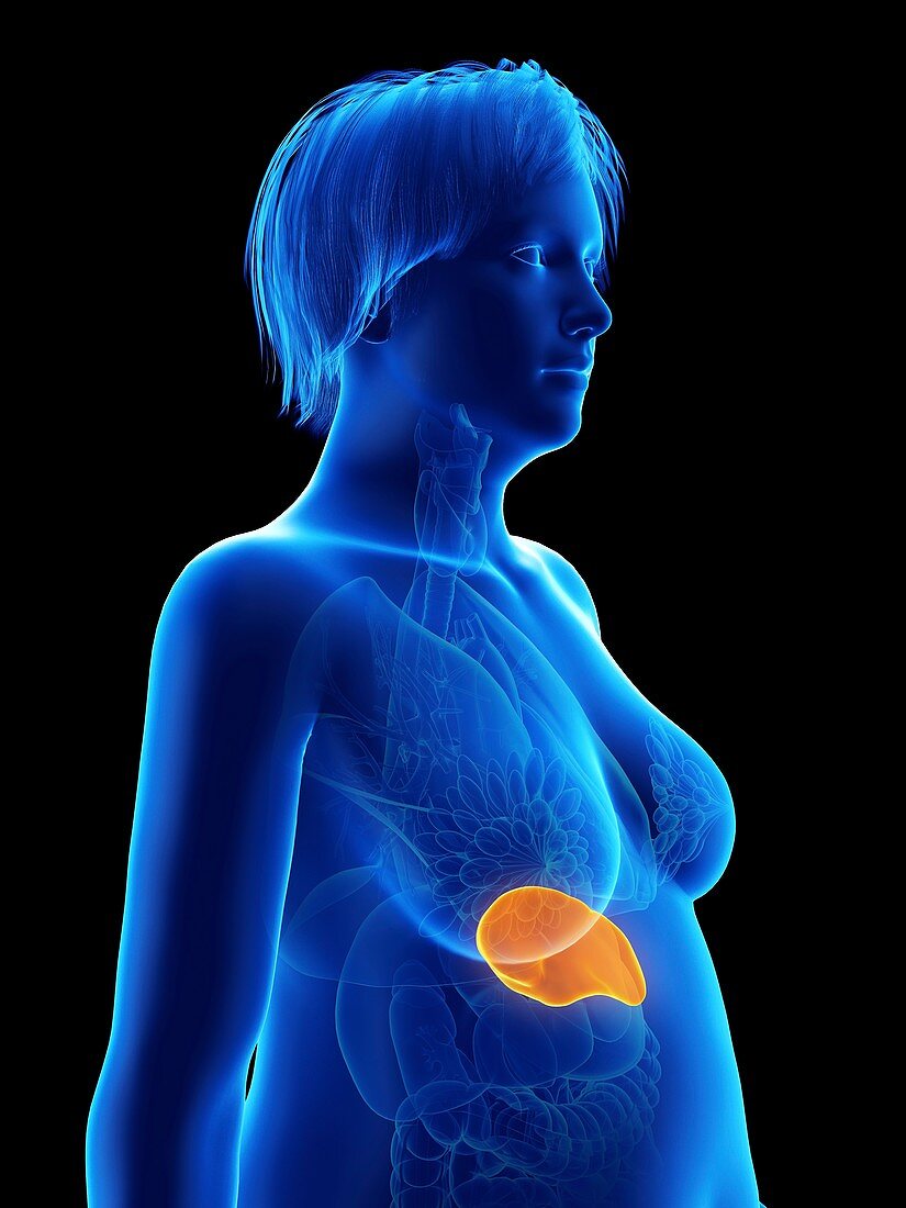 Illustration of an obese woman's spleen