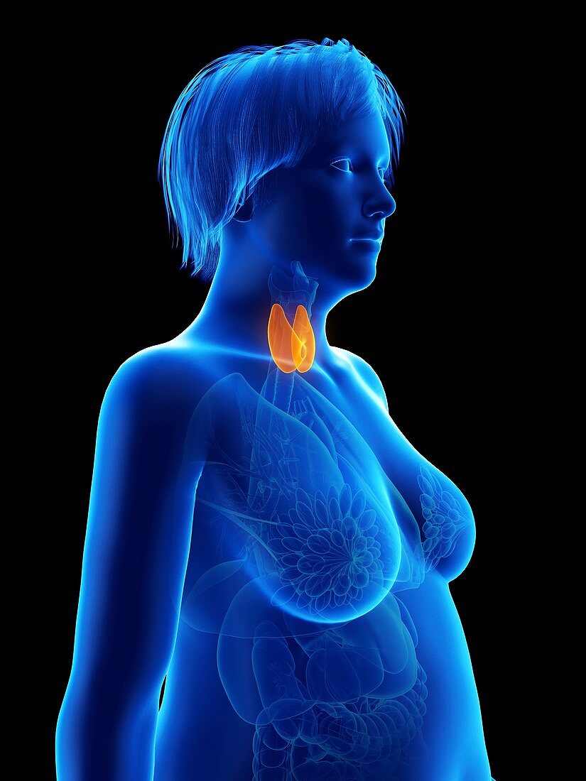 Illustration of an obese woman's thyroid gland