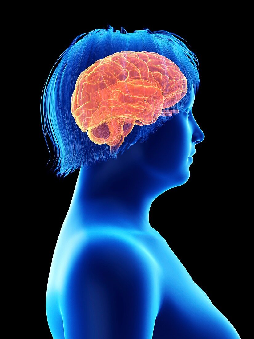 Illustration of an obese woman's brain