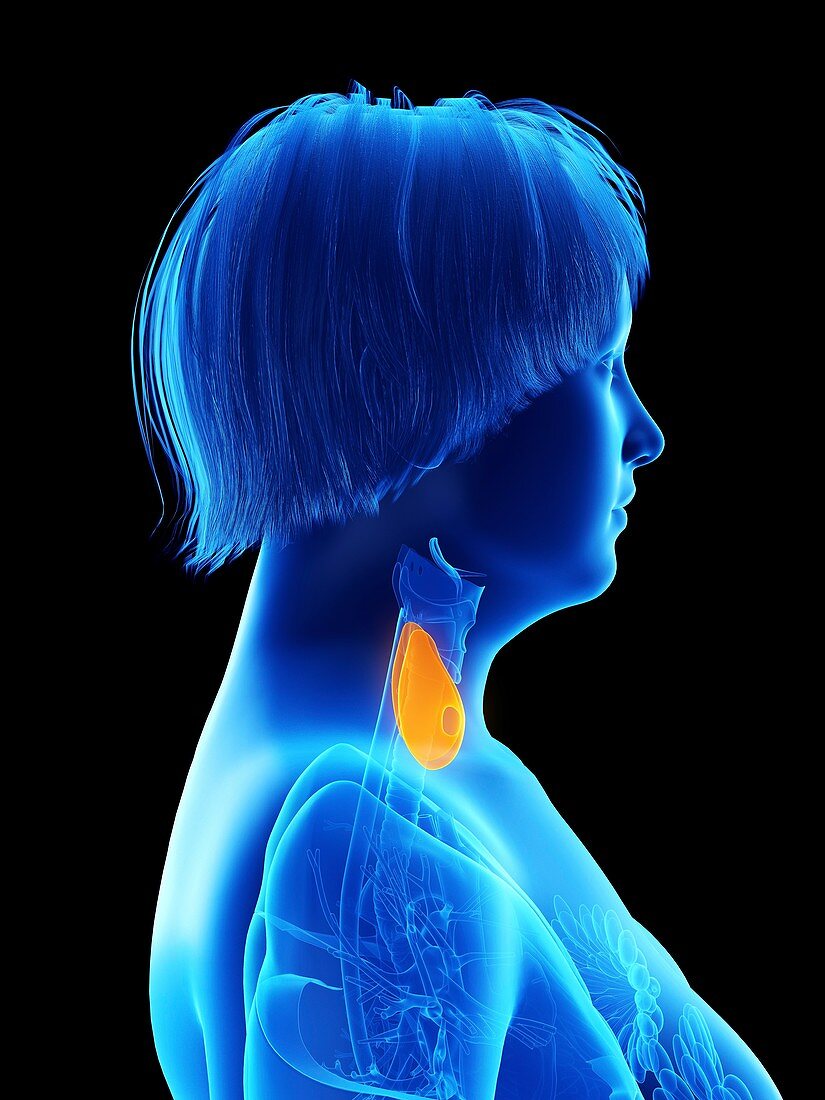 Illustration of an obese woman's thyroid gland