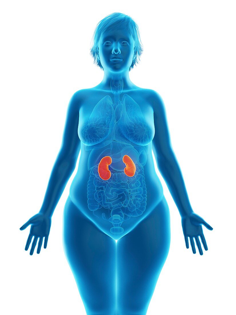 Illustration of an obese woman's kidneys