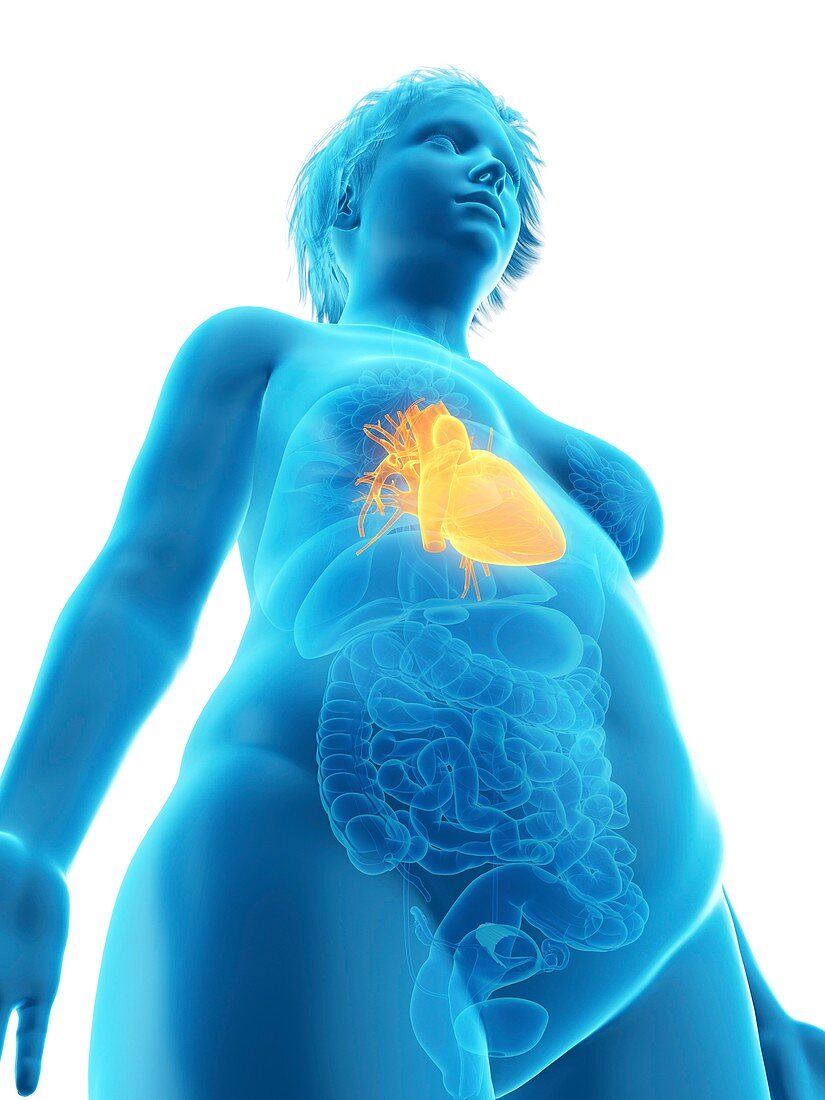 Illustration of an obese woman's heart