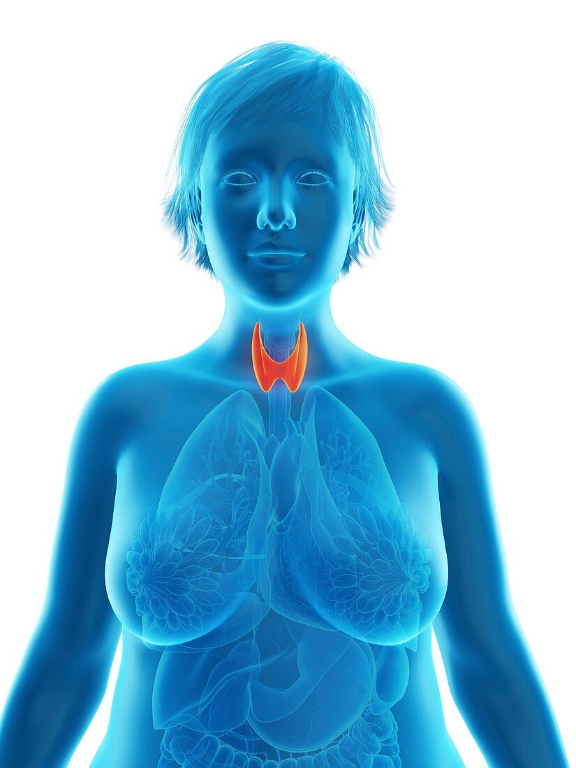 Illustration of an obese woman's thyroid gland