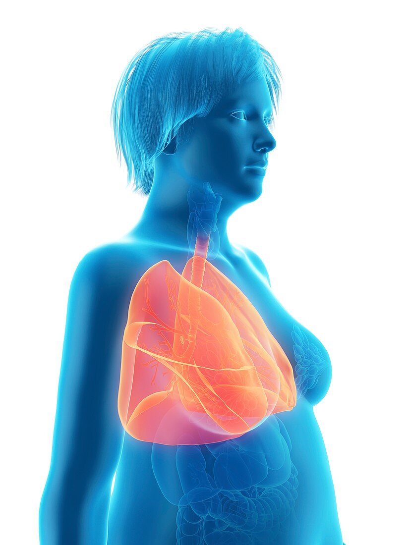 Illustration of an obese woman's lung