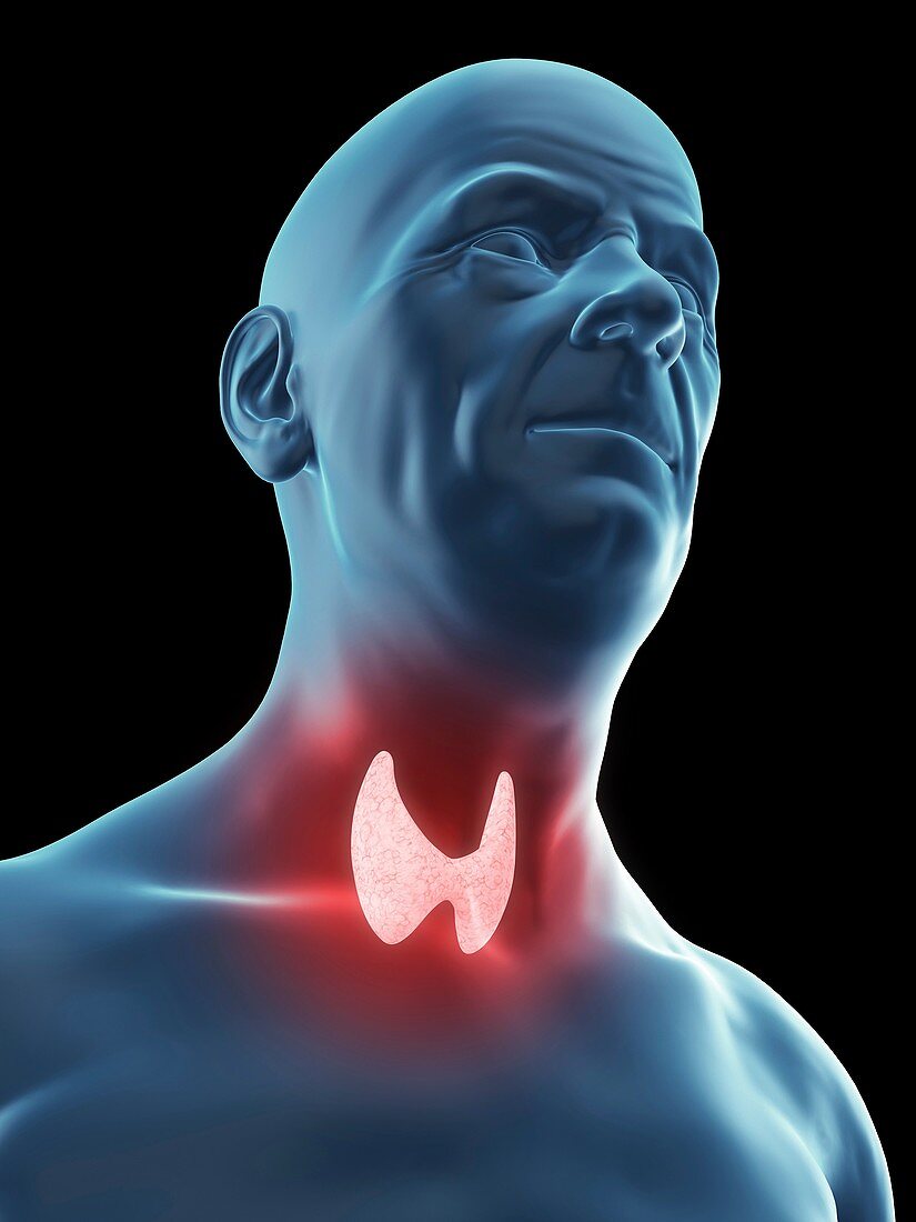 Illustration of an old man's thyroid gland