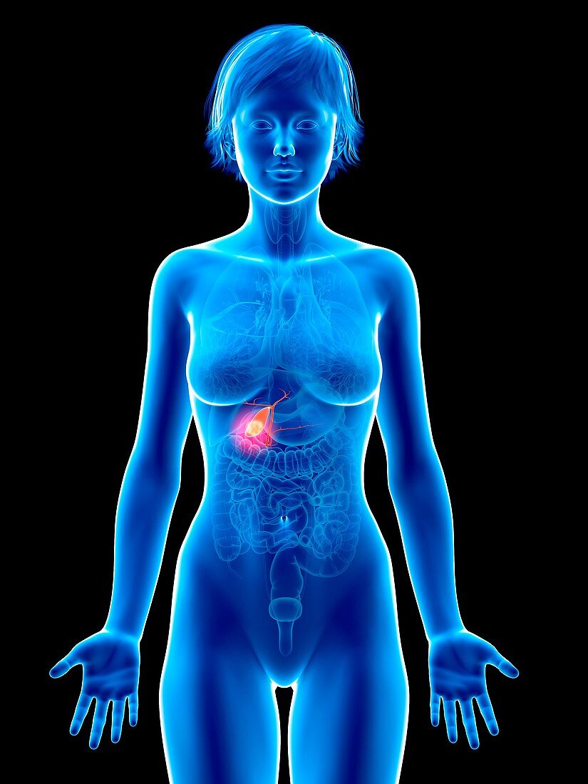 Illustration of gallbladder cancer