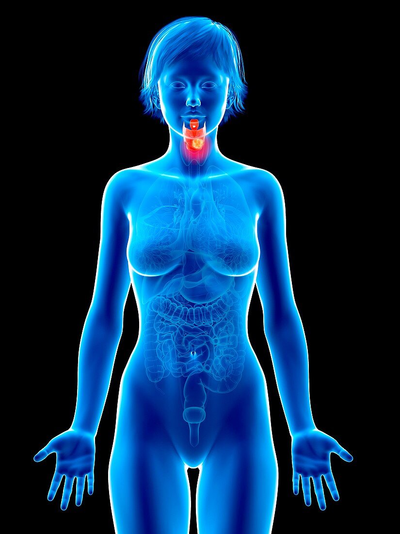 Illustration of larynx cancer