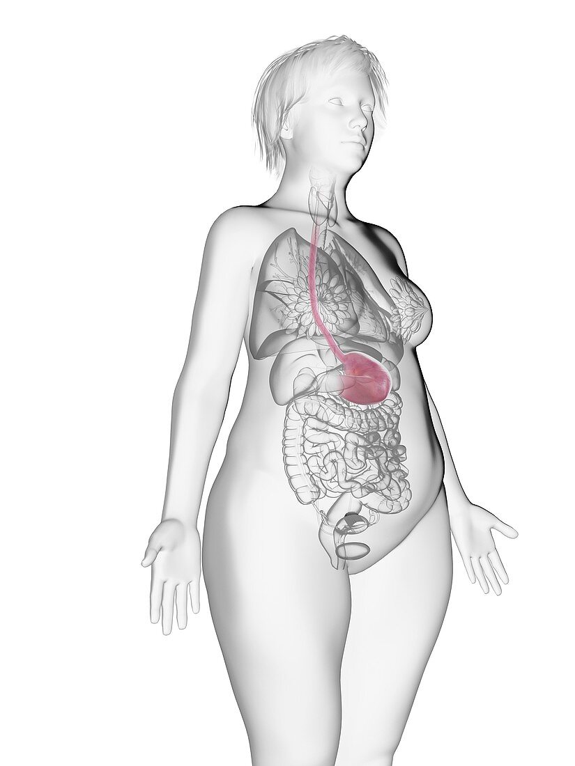 Illustration of an obese woman's stomach