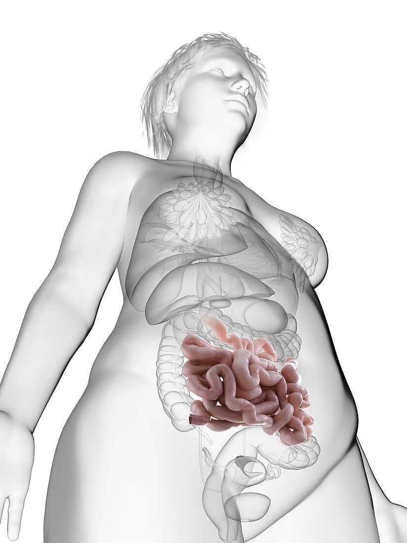 Illustration of an obese woman's small intestine