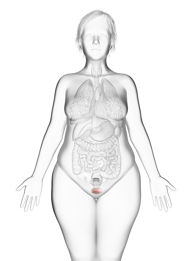 Illustration of an obese woman's bladder