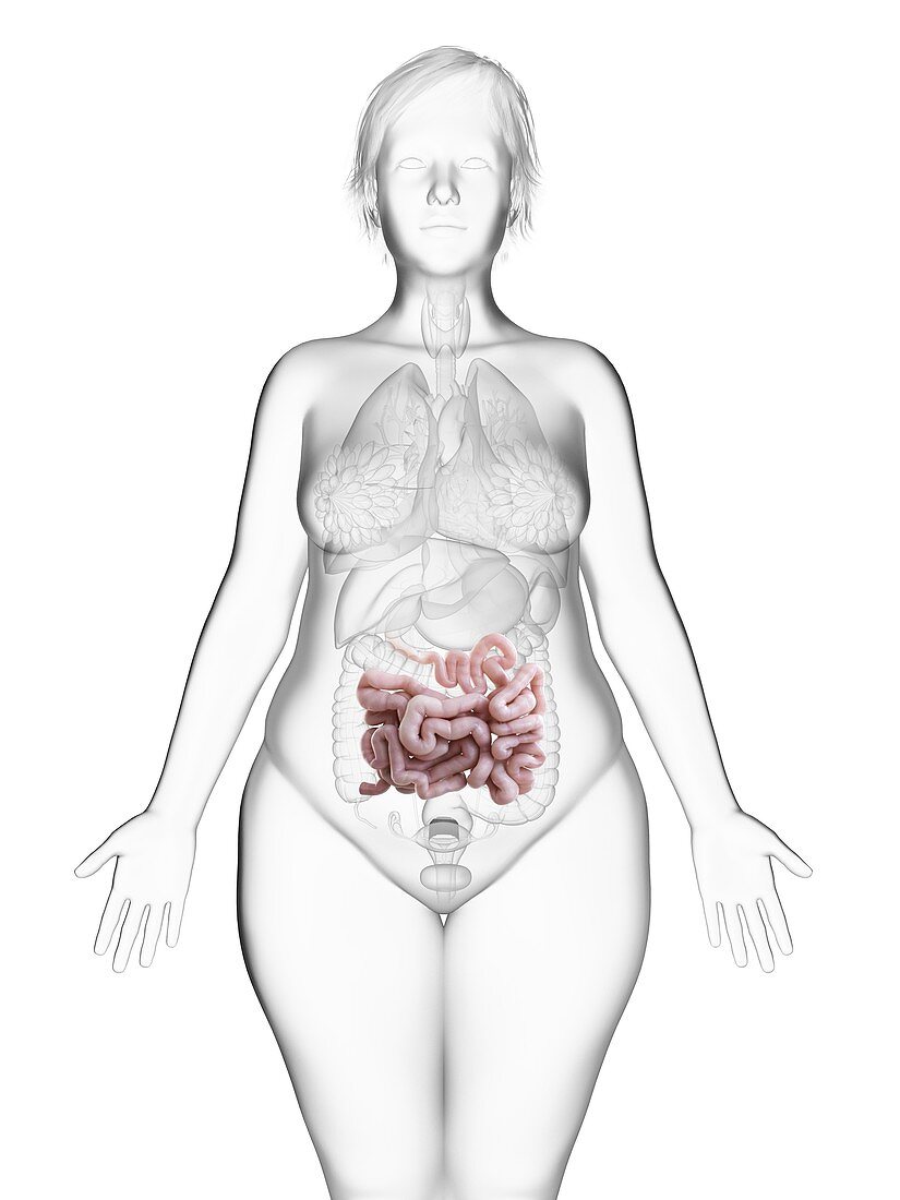 Illustration of an obese woman's small intestine