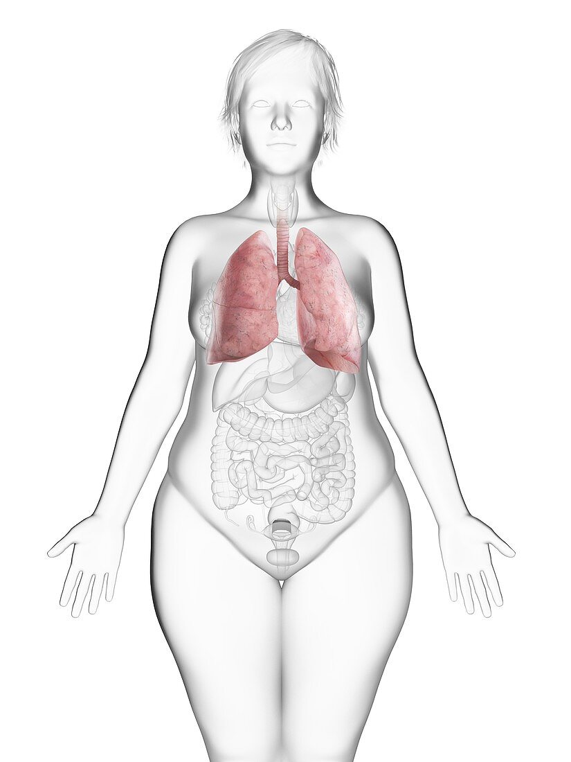 Illustration of an obese woman's lung