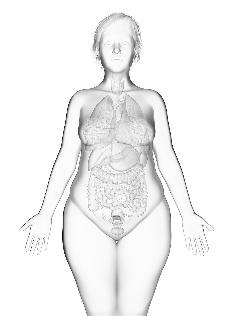 Illustration of an obese woman's internal organs