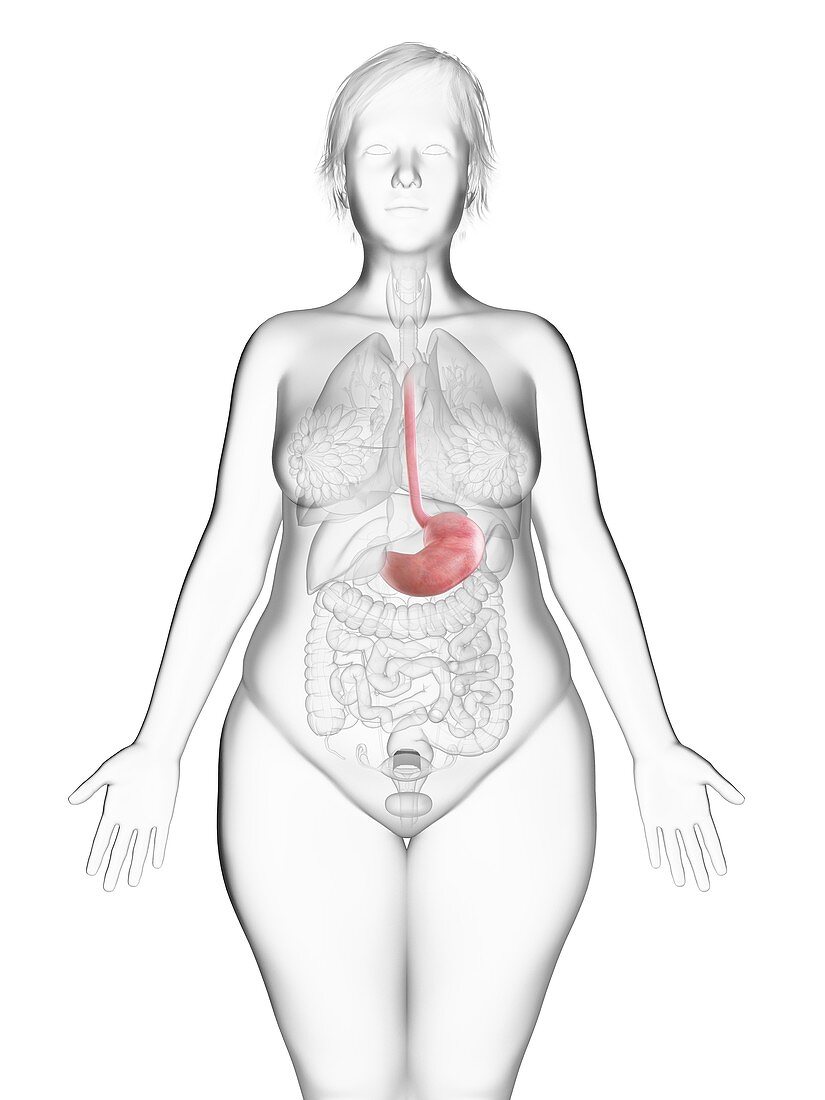 Illustration of an obese woman's stomach