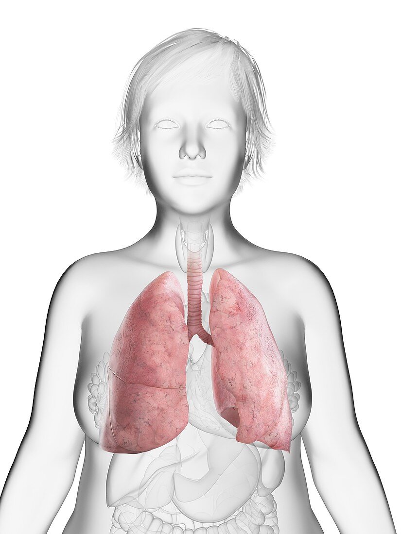 Illustration of an obese woman's lung