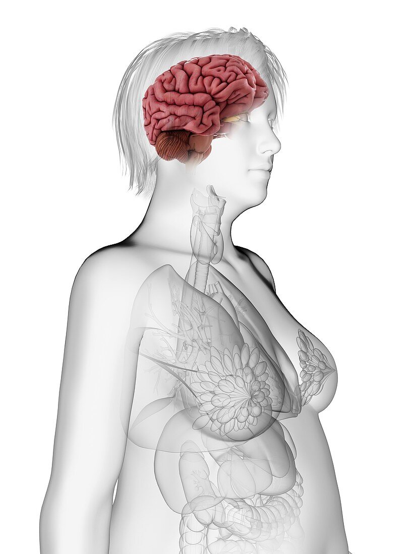 Illustration of an obese woman's brain