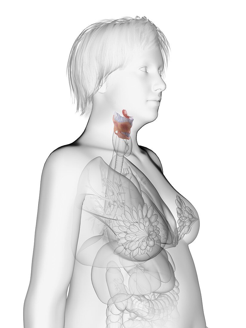 Illustration of an obese woman's larynx