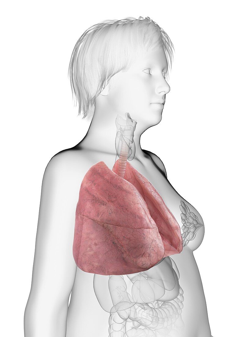 Illustration of an obese woman's lung