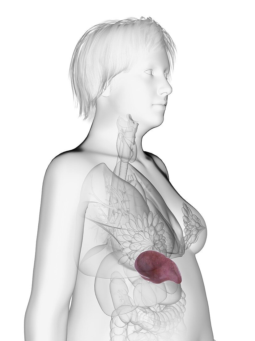 Illustration of an obese woman's spleen
