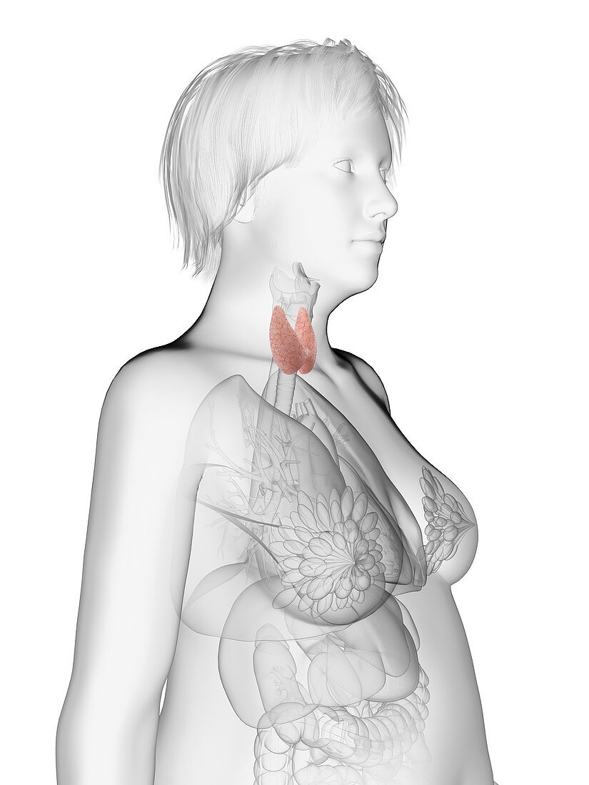 Illustration of an obese woman's thyroid gland