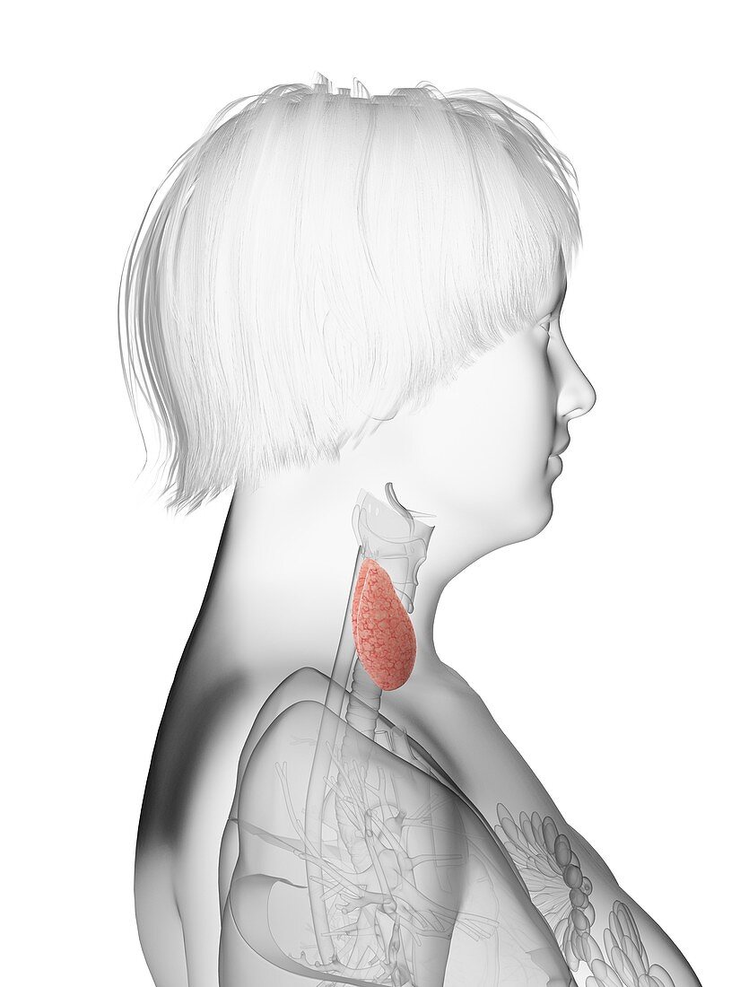 Illustration of an obese woman's thyroid gland