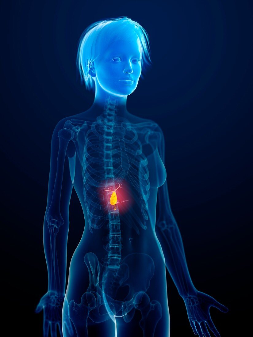 Illustration of an inflamed gallbladder