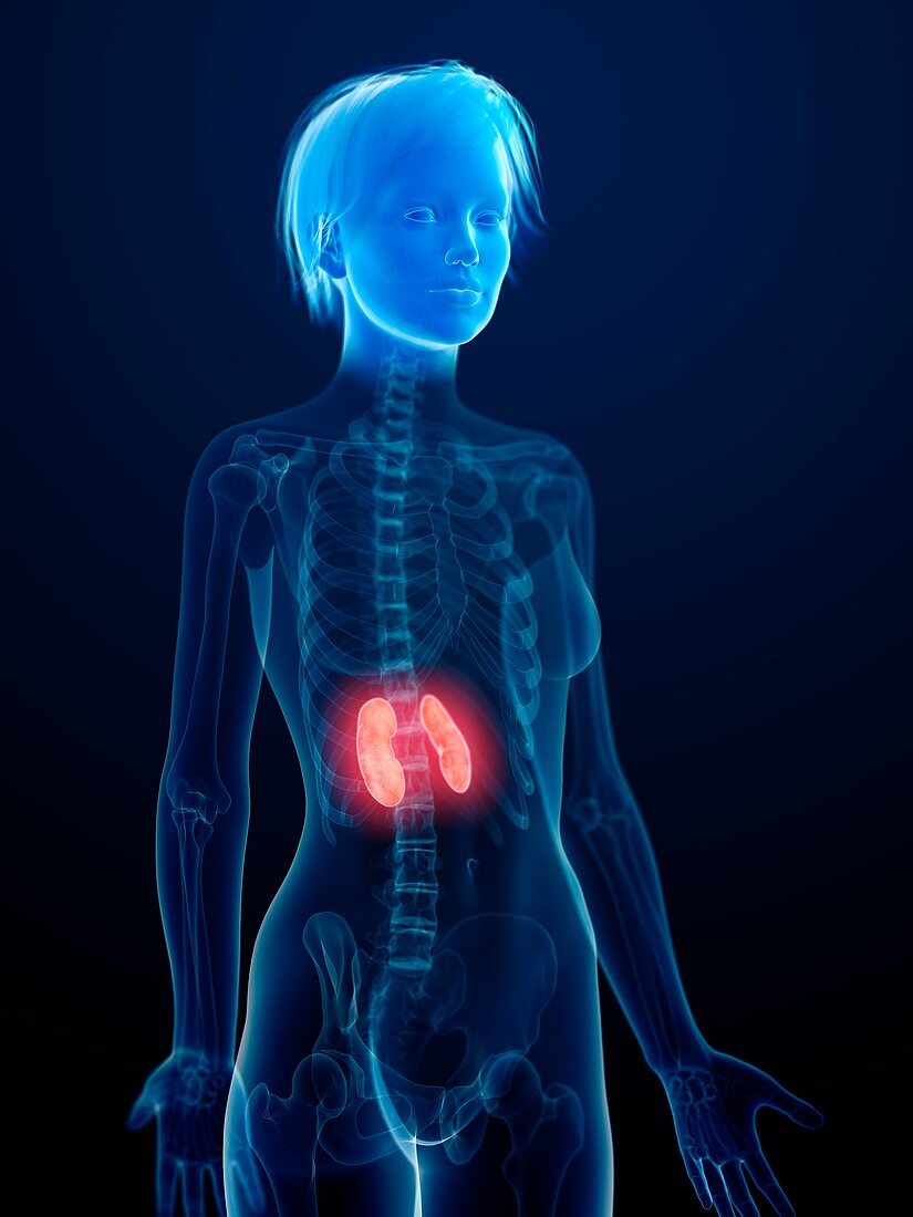 Illustration of inflamed kidneys