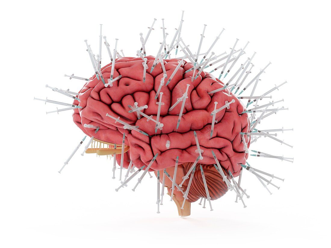 Illustration of a brain and syringes