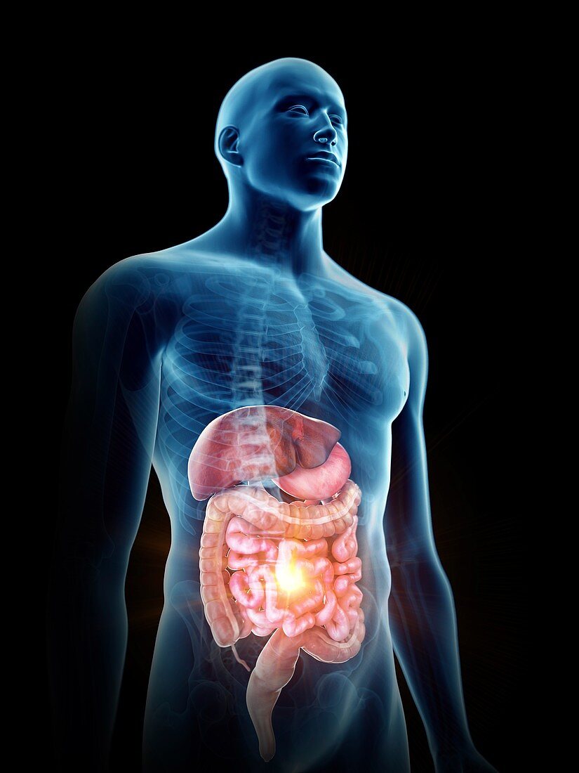 Illustration of a painful digestive system