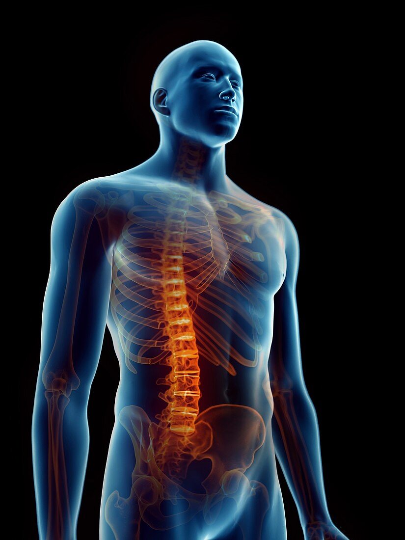 Illustration of a man's painful spine