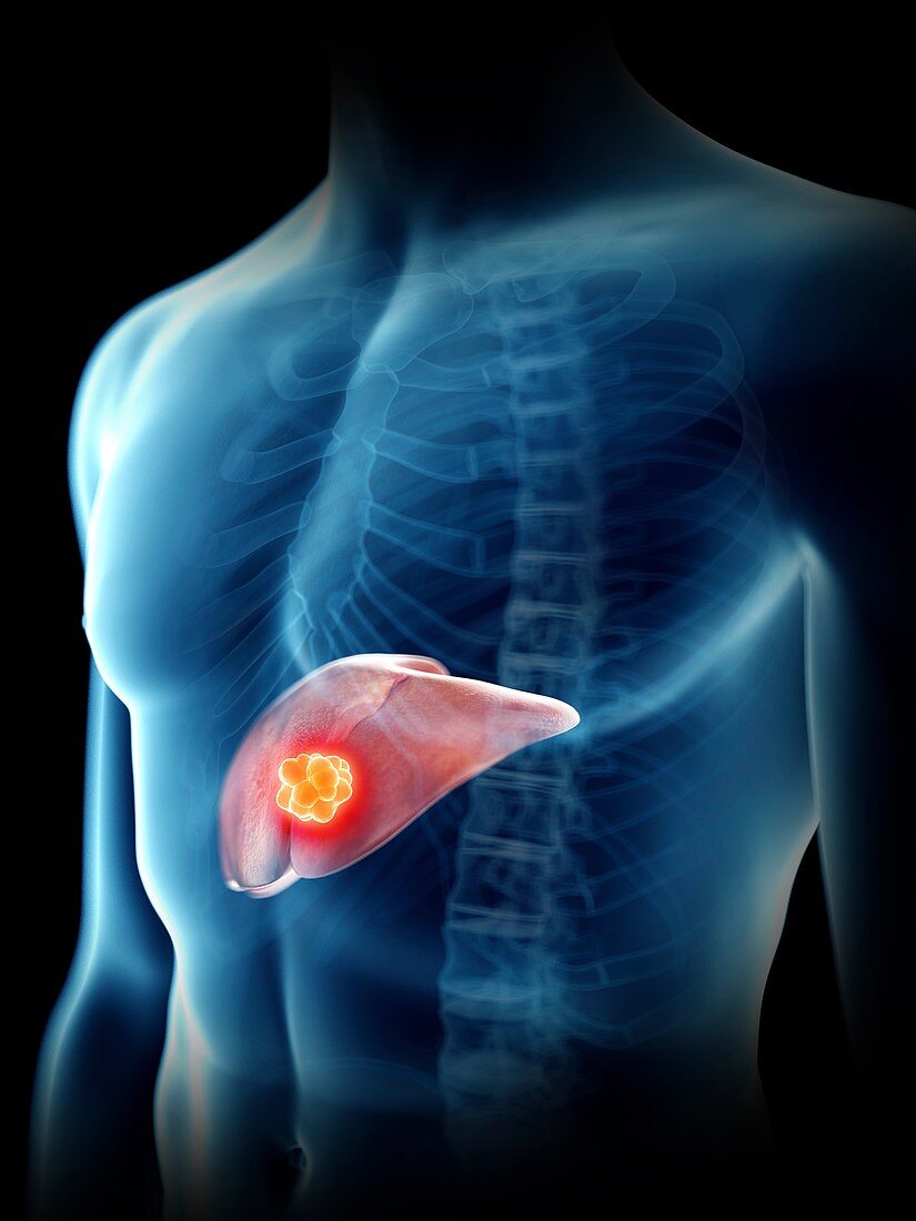 Illustration of a man's liver