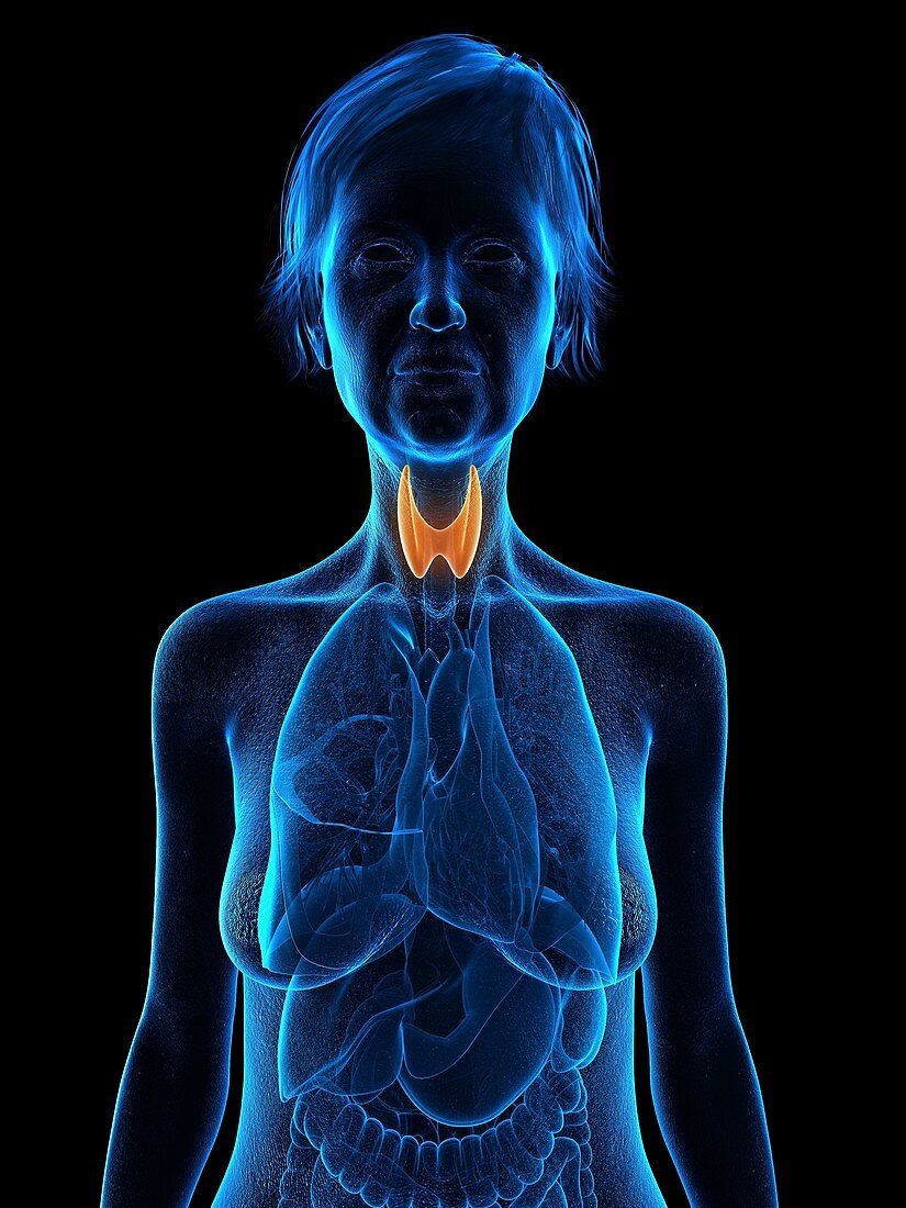 Illustration of an old woman's thyroid gland