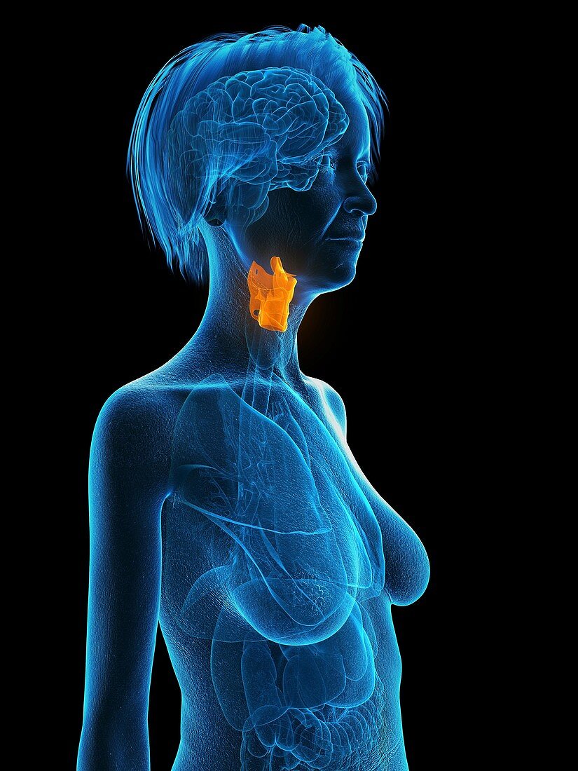 Illustration of an old woman's larynx