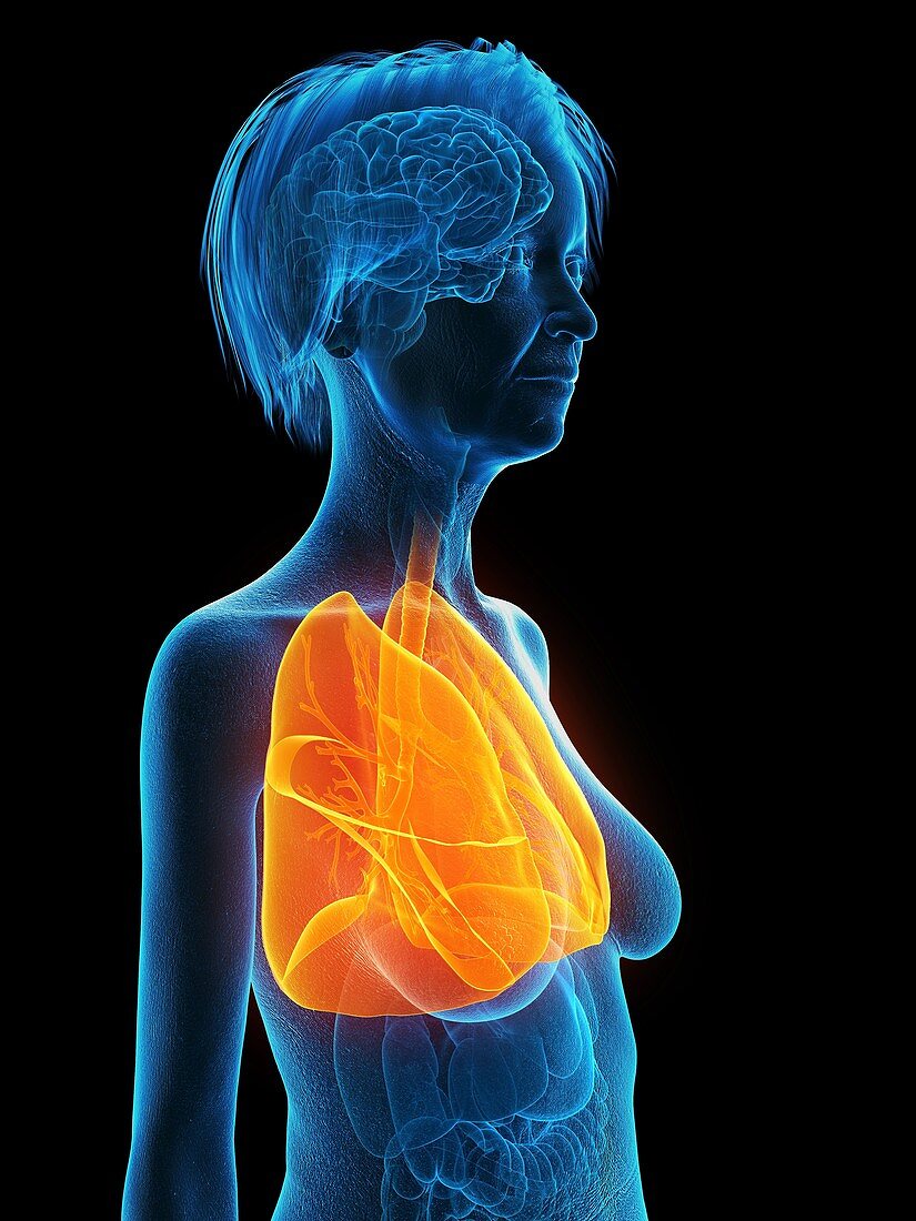 Illustration of an old woman's lung