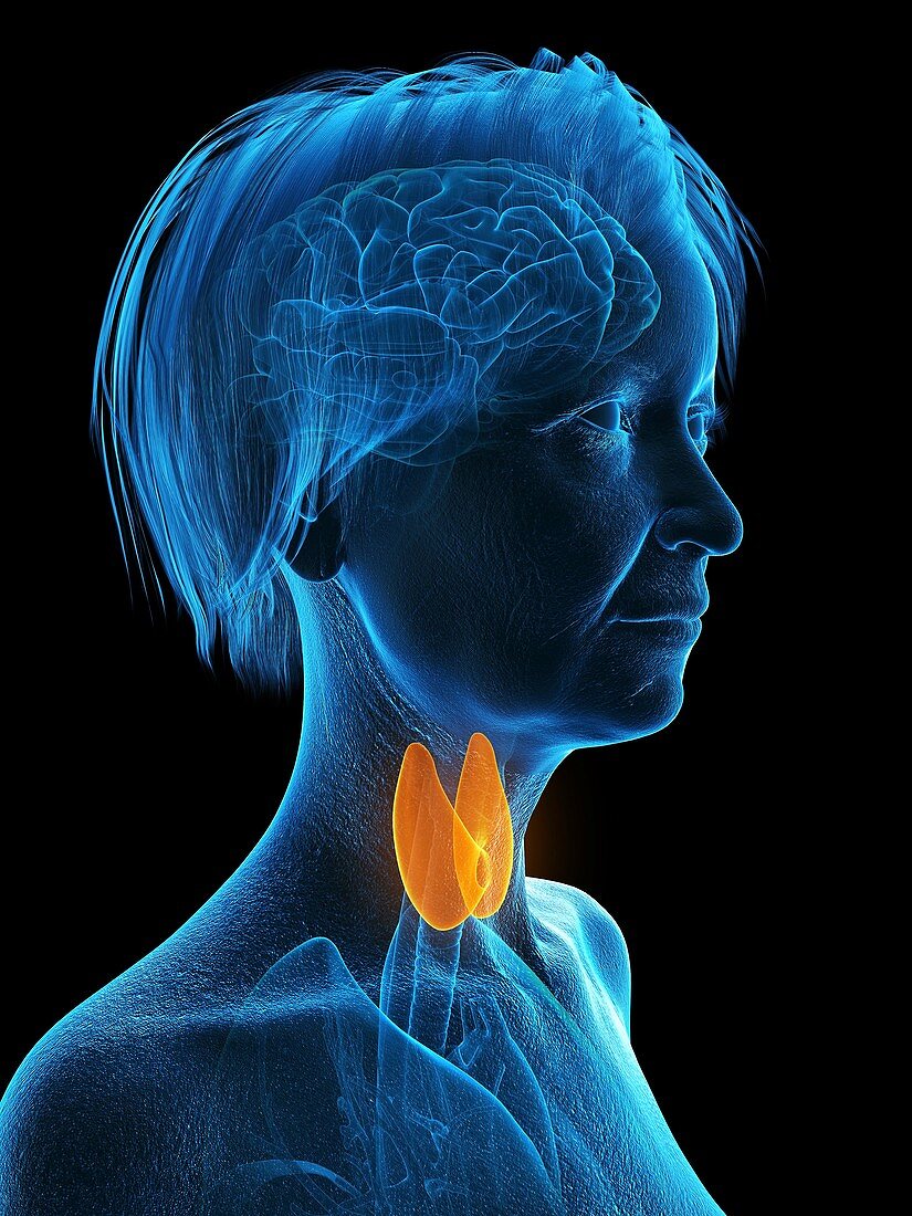 Illustration of an old woman's thyroid gland