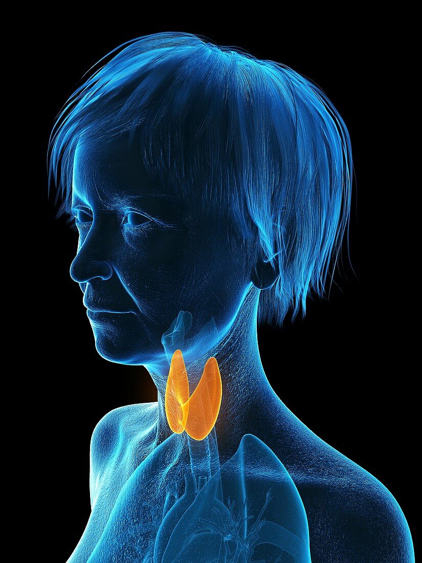 Illustration of an old woman's thyroid