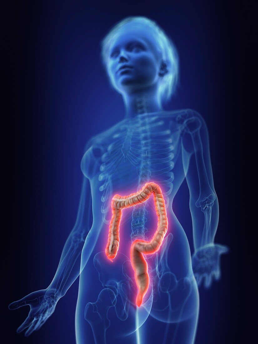 Illustration of an inflamed colon