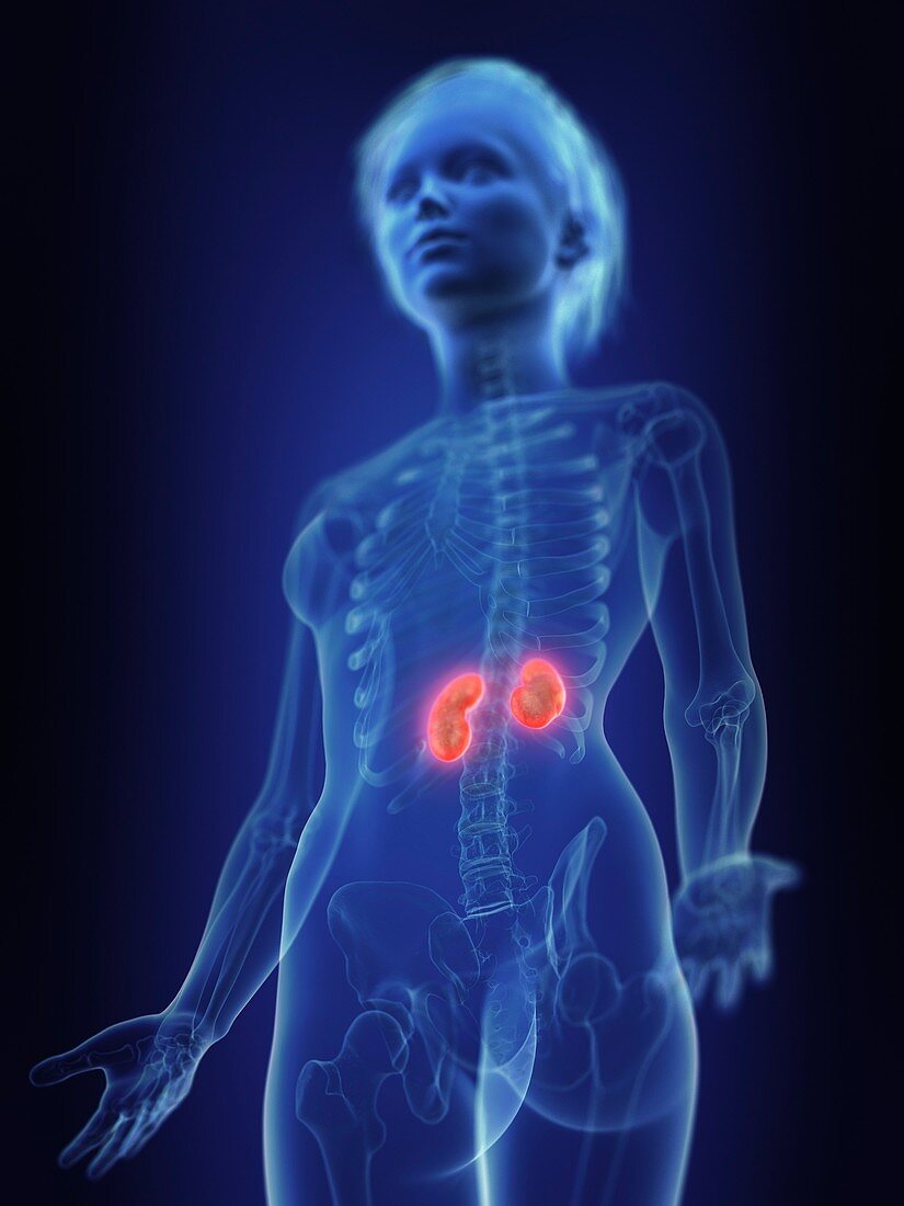 Illustration of inflamed kidneys