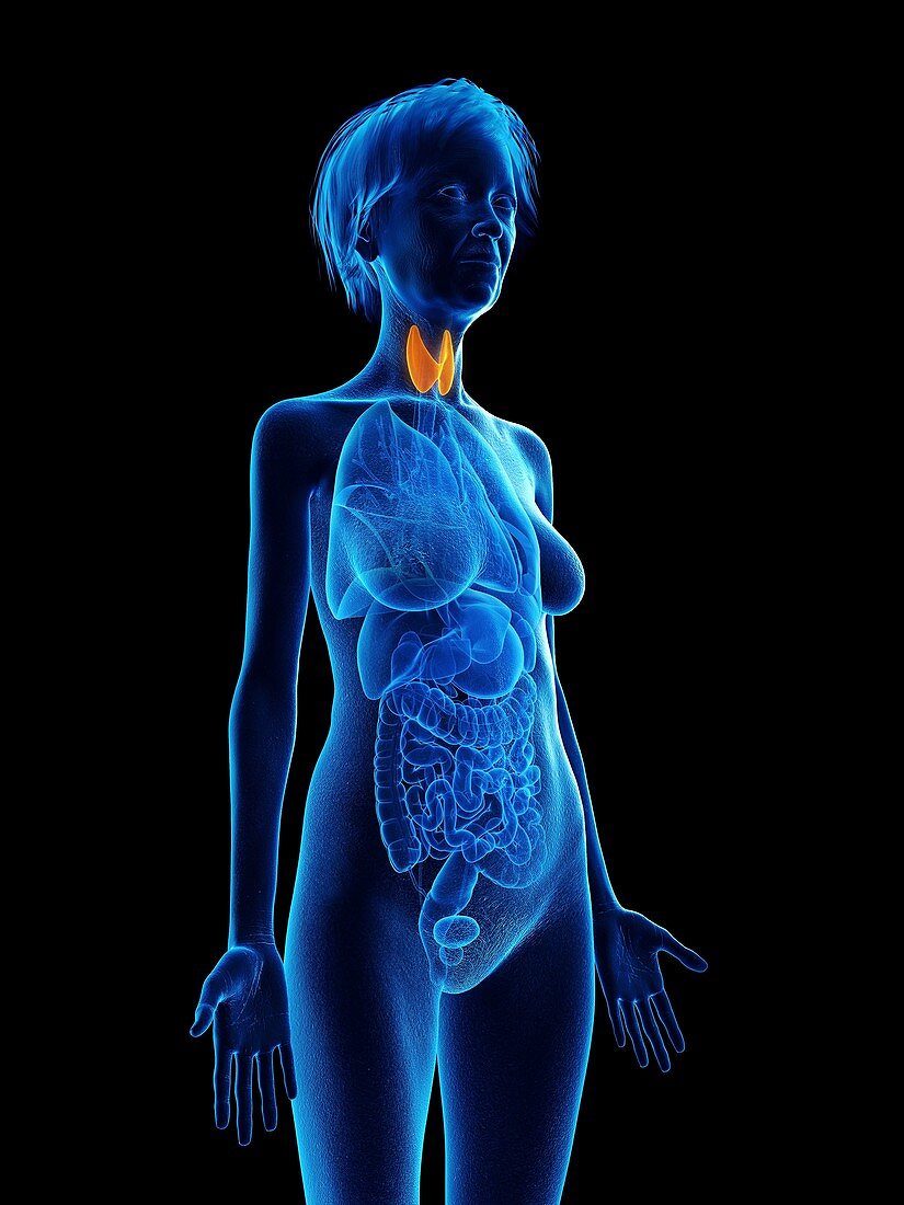 Illustration of an old woman's thyroid gland