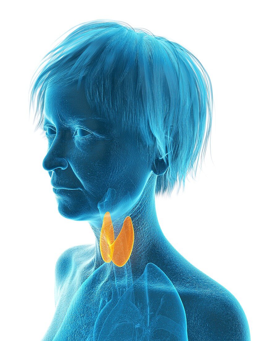 Illustration of an old woman's thyroid gland