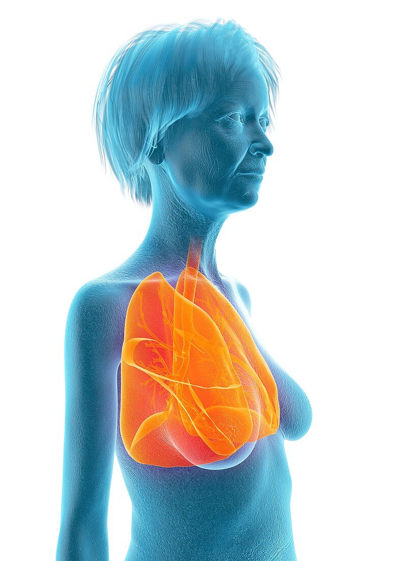 Illustration of an old woman's lung