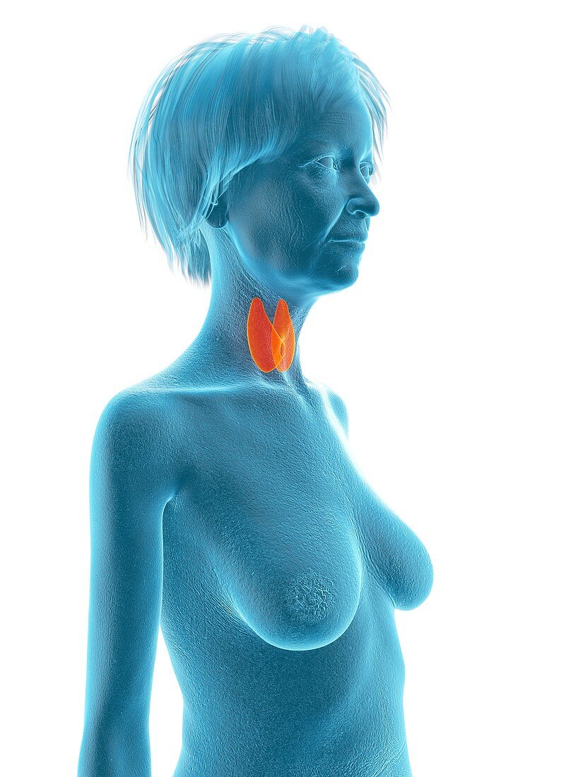 Illustration of an old woman's thyroid gland