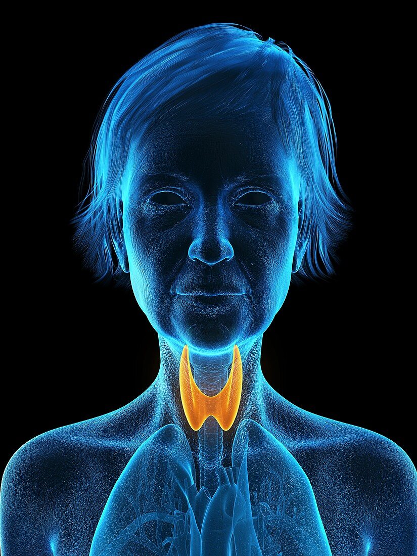 Illustration of an old woman's thyroid gland