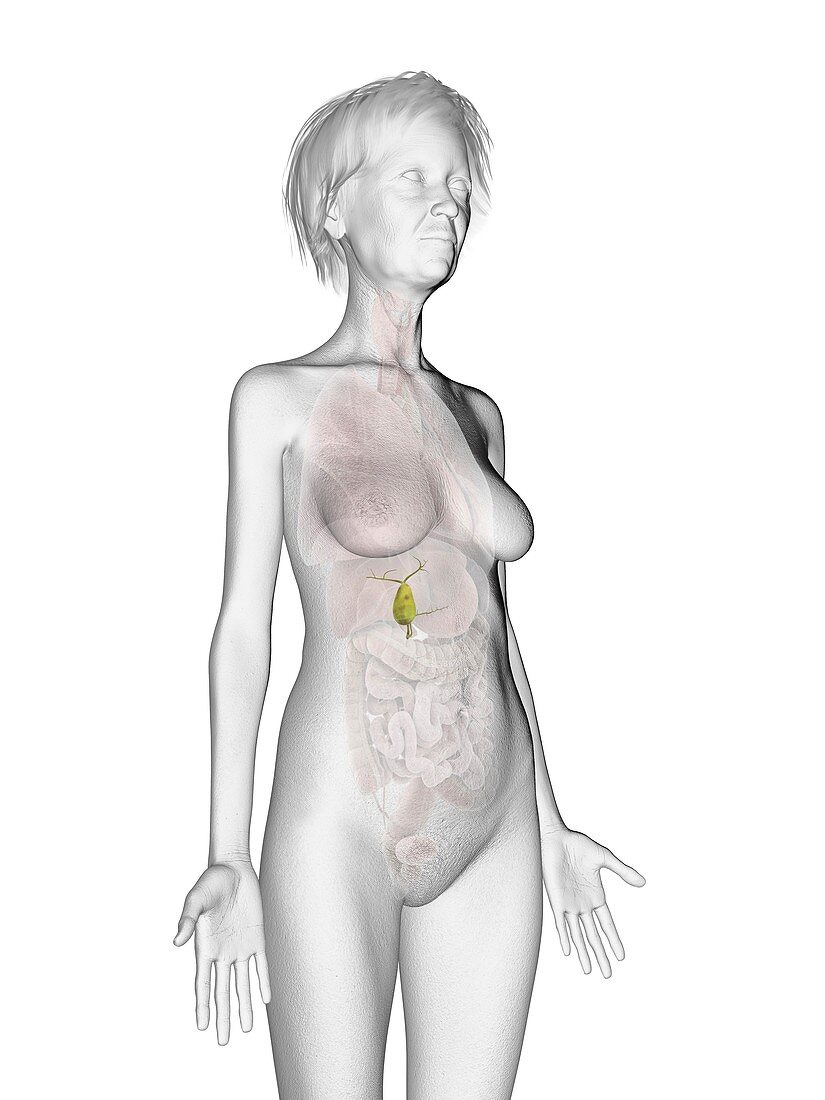 Illustration of an old woman's gallbladder