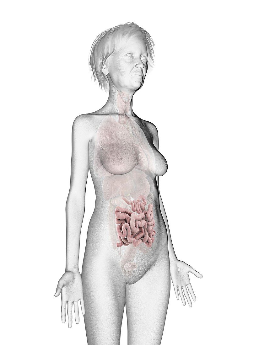 Illustration of an old woman's small intestines